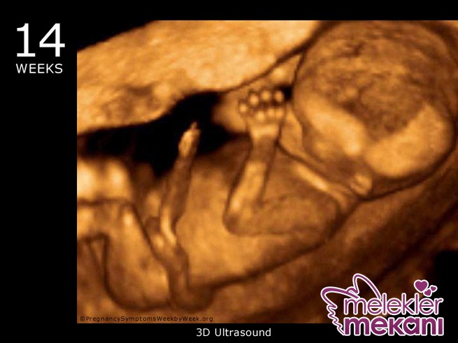 14_week_ultrasound_3d.JPG