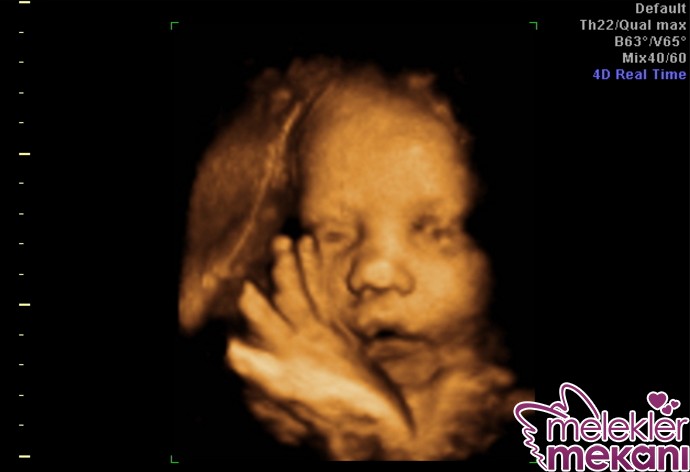 37 haftalik bebek 3d ultrason.jpg