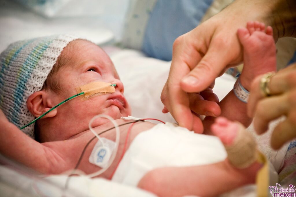 Prematüre Bebek Mucize Bebeklere Geniş Çaplı Bir Bakış Melek Mekanı